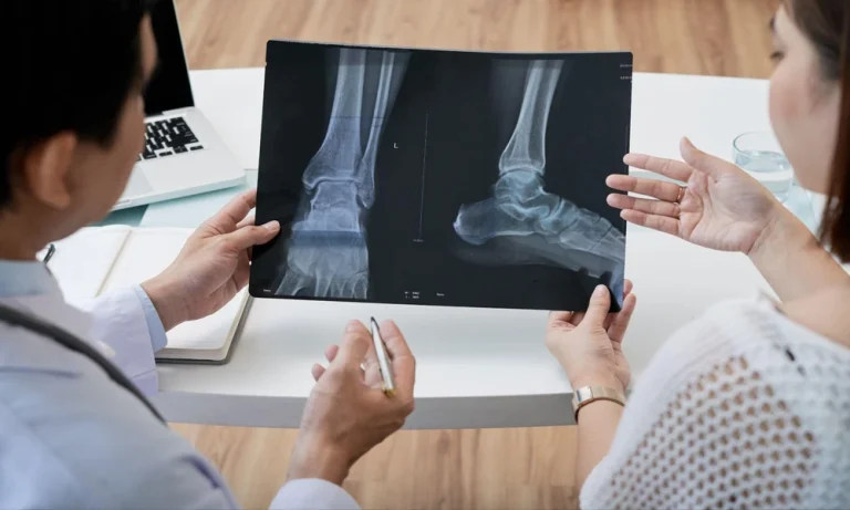Sprain vs. Fracture: How to Tell if Your Ankle is Really Broken